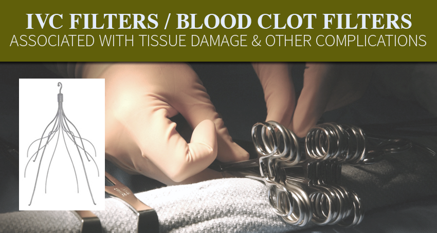 Why File an IVC Filter Lawsuit // Monroe Law Group